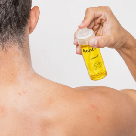 Очищуючий спрей для тіла Acnemy Zitback Body Spray з гліколевою кислотою, ніацинамідом, екстр. нони 80ml — фото 2