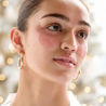 Святковий набір Patchology Under The Mistletoe 2025 — компактний формат, ідеальний подарунок, для впевненого святкового образу
