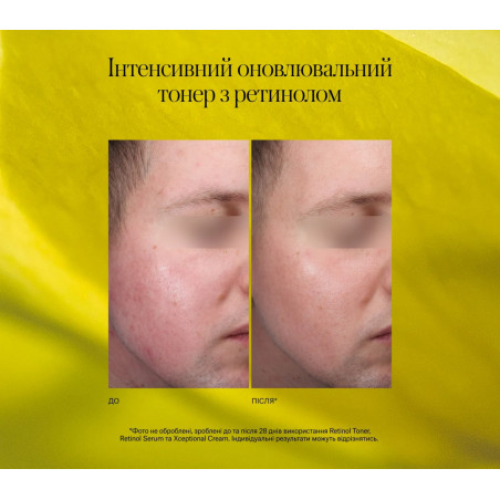 Відновлювальний тонік Instytutum з ретинолом 150 мл | Smart Beauty