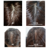 Тонік для росту волосся Dr. FORHAIR Folligen Tonic 120ml — зміцнює корені, запобігає випаданню, біотин, м'ята, женьшень —