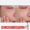 Омолоджувальна сироватка Medi-Peel Melanon X Ampoule 50ml — з ретинолом, освітлення, зволоження, ліфтинг, усунення тьмяності —